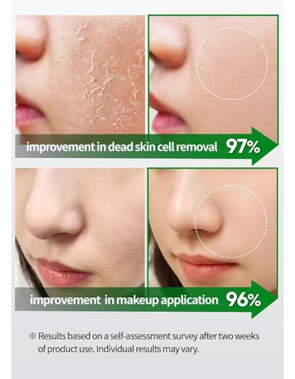 BEAUDIANI Green BHA Peeling Pad 60ct | Korean Exfoliating Toner Pads | Minimize Pores, Soothe Blemish-Prone Skin | Gentle Daily Chemical Exfoliant | K-Beauty Skincare