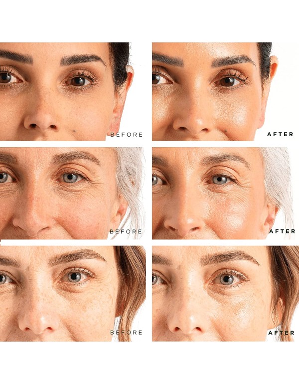 Tree of Life Vitamin C, Retinol and Hyaluronic Acid serum for Brightening, Firming, & Hydrating for Face - 3 Ct x 1 Fl Oz - Total Skin Reset, Anti Aging , Dark Spot Correcting